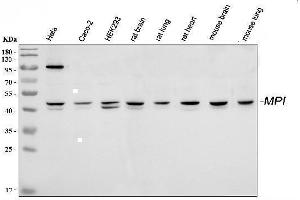 Western blot analysis of MPI using anti-MPI antibody (ABIN4886672). (MPI Antikörper  (AA 2-99))