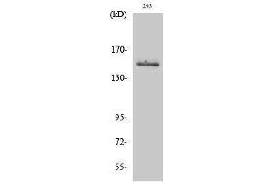 Western Blotting (WB) image for anti-Tyrosine Kinase 2 (TYK2) (Tyr260) antibody (ABIN3177844) (TYK2 Antikörper  (Tyr260))