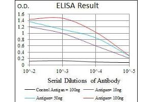 Black line: Control Antigen (100 ng), Purple line: Antigen(10 ng), Blue line: Antigen (50 ng), Red line: Antigen (100 ng), (LPA Antikörper  (AA 4330-4521))