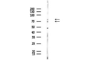anti-CDK5 Regulatory Subunit Associated Protein 1-Like 1 (CDKAL1) (N-Term) antibody