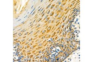 Immunohistochemistry of paraffin embedded human esophagus using Notch4 (ABIN7074863) at dilution of 1:600 (400x lens)