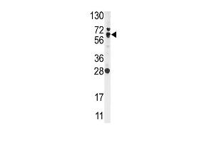 Western Blotting (WB) image for anti-Nuclear Factor (erythroid-Derived 2)-Like 2 (NFE2L2) (AA 30-59), (N-Term) antibody (ABIN391424)