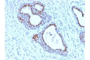 Formalin-fixed, paraffin-embedded human Tonsil stained with FOXA1 Rabbit Recombinant Monoclonal Antibody (FOXA1/2230R). (Rekombinanter FOXA1 Antikörper  (AA 372-472))