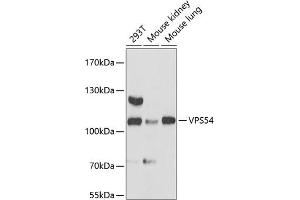 Western blot analysis of extracts of various cell lines, using VPS54 antibody (ABIN6133042, ABIN6150144, ABIN6150145 and ABIN6217132) at 1:3000 dilution. (VPS54 Antikörper  (AA 420-720))