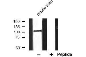 Western blot analysis of PERK expression in mouse brain (PERK Antikörper  (C-Term))