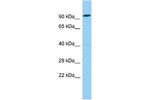 Host: Rabbit Target Name: CEP85L Sample Type: Fetal Liver lysates Antibody Dilution: 1. (C6orf204 Antikörper  (N-Term))