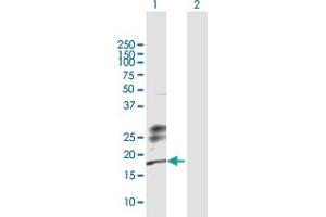 Western Blotting (WB) image for anti-Killer Cell Lectin-Like Receptor Subfamily G, Member 1 (KLRG1) (AA 1-189) antibody (ABIN523620)