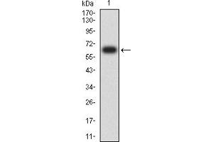Western blot analysis using CD334 mAb against human CD334 (AA: extra 22-369) recombinant protein. (FGFR4 Antikörper  (AA 22-369))