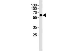 Western blot analysis of lysate from rat lung tissue using SMAD1 antibody at 1:1000.
