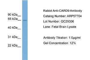 WB Suggested Anti-CARD9  Antibody Titration: 0. (CARD9 Antikörper  (Middle Region))