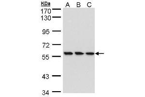 WB Image Sample (30 ug of whole cell lysate) A: HeLa B: Hep G2 , C: MOLT4 , 7. (RNGTT Antikörper)