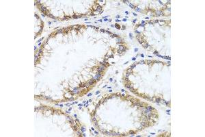 Immunohistochemistry of paraffin-embedded human stomach using GPM6A antibody (ABIN6134764, ABIN6141338, ABIN6141340 and ABIN6224880) at dilution of 1:100 (40x lens). (GPM6A Antikörper  (AA 1-100))