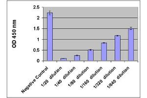 8-OHdG Levels in Human Urine. (Oxidative DNA Damage ELISA Kit)