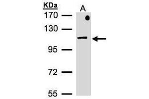 Western Blotting (WB) image for anti-Adaptor-Related Protein Complex 2, beta 1 Subunit (AP2B1) (Internal Region) antibody (ABIN2855154)