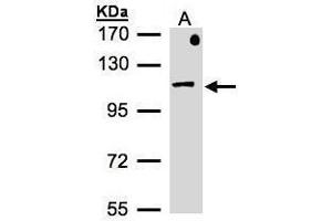 WB Image Sample(30 μg of whole cell lysate) A:MOLT4, 7. (AP2B1 Antikörper  (Internal Region))