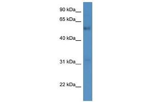 Western Blot showing FAM126A antibody used at a concentration of 1-2 ug/ml to detect its target protein. (FAM126A Antikörper  (C-Term))