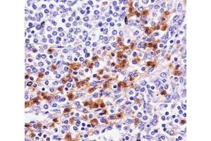 Immunohistochemistry (IHC) image for anti-Integrin alpha M (ITGAM) (AA 253-282) antibody (ABIN3031364)