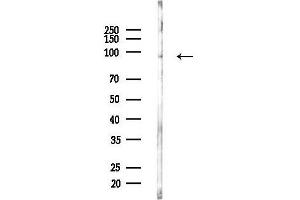 anti-Filaggrin (FLG) (C-Term) antibody
