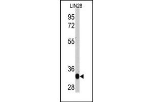 Western Blotting (WB) image for anti-Lin-28 Homolog A (C. Elegans) (LIN28A) antibody (ABIN356385) (LIN28A Antikörper)