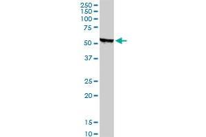 Western Blotting (WB) image for anti-serine/threonine Kinase 38 (STK38) (AA 1-466) antibody (ABIN599179) (STK38 Antikörper  (AA 1-466))