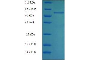 SDS-PAGE (SDS) image for Aldolase B, Fructose-Bisphosphate (ALDOB) (AA 2-364) protein (His-SUMO Tag) (ABIN5709039)