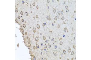 Immunohistochemistry (Paraffin-embedded Sections) (IHC (p)) image for anti-Hemoglobin, alpha 2 (HBa2) (AA 1-142) antibody (ABIN6141637)