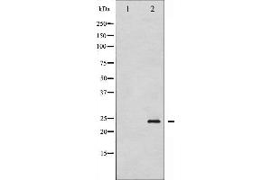 Western blot analysis of Caveolin-1 phosphorylation expression in H2O2 treated NIH-3T3 whole cell lysates,The lane on the left is treated with the antigen-specific peptide. (Caveolin-1 Antikörper  (pTyr14))
