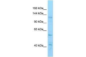 WB Suggested Anti-Hdac6 Antibody   Titration: 1. (HDAC6 Antikörper  (C-Term))