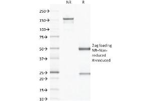 SDS-PAGE Analysis Purified CD79b Mouse Monoclonal Antibody (IGB/1843). (CD79b Antikörper  (AA 29-159))