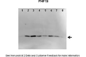 Lanes:   1. (PHF19 Antikörper  (C-Term))