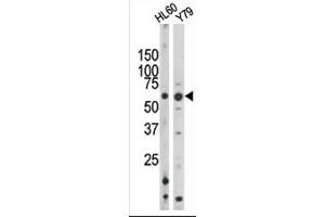 The anti-Phospho-Rad9- Pab (ABIN389633 and ABIN2839629) is used in Western blot to detect Phospho-Rad9- in HL60 (left) and Y79 (right) tissue lysates. (RAD9A Antikörper  (pSer328))