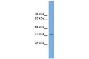 Image no. 1 for anti-Sprouty Homolog 3 (SPRY3) (AA 71-120) antibody (ABIN6744884) (SPRY3 Antikörper  (AA 71-120))