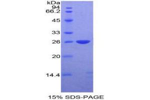 SDS-PAGE (SDS) image for DIX Domain Containing 1 (DIXDC1) (AA 513-711) protein (His tag) (ABIN1878319)