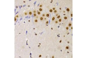Immunohistochemistry of paraffin-embedded rat brain using HNRNPA1 Antibody (ABIN5975570) at dilution of 1/100 (40x lens). (HNRNPA1 Antikörper)