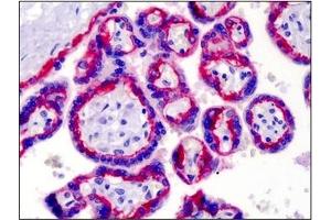 Immunohistochemistry (IHC) image for anti-Integrin beta 4 (ITGB4) antibody (ABIN614431) (Integrin beta 4 Antikörper)