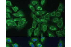 Immunofluorescence analysis of U-2 OS cells using EIF3D Polyclonal Antibody at dilution of 1:100.