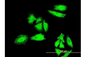 Immunofluorescence of monoclonal antibody to MKNK1 on HeLa cell. (MKNK1 Antikörper  (AA 1-465))