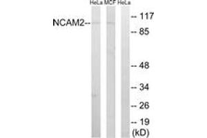 Western blot analysis of extracts from MCF-7/HeLa cells, using NCAM2 Antibody. (NCAM2 Antikörper  (AA 264-313))