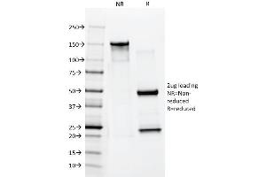 SDS-PAGE Analysis Purified Cytokeratin 10 Mouse Monoclonal Antibody (AE20). (Keratin 10 Antikörper)