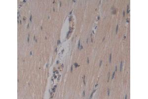 IHC-P analysis of Kidney tissue, with DAB staining. (Junctophilin 1 Antikörper  (AA 1-201))