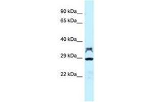 Image no. 1 for anti-Protein Phosphatase 2, Catalytic Subunit, alpha Isozyme (PPP2CA) (AA 188-237) antibody (ABIN6747823) (PPP2CA Antikörper  (AA 188-237))