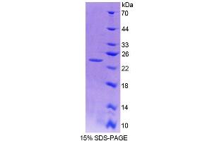 SDS-PAGE analysis of Mouse NIN Protein. (Ninein Protein)