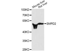 Western blot analysis of extracts of various cell lines, using SMPD2 antibody (ABIN1874877) at 1:3000 dilution. (SMPD2 Antikörper)