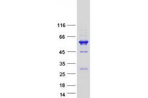 Validation with Western Blot (CCDC114 Protein (Transcript Variant 2) (Myc-DYKDDDDK Tag))
