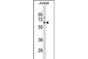 XYLB Antibody (N-term) (ABIN1539119 and ABIN2849290) western blot analysis in Jurkat cell line lysates (35 μg/lane). (XYLB Antikörper  (N-Term))