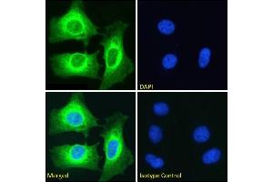 Immunofluorescence staining of fixed HeLa cells with anti-NFKB2 antibody SAIC-26C-15. (Rekombinanter NFKB2 Antikörper)