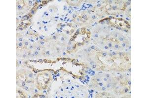 Immunohistochemistry of paraffin-embedded Rat kidney using B9D1 Polyclonal Antibody at dilution of 1:100 (40x lens). (B9D1 Antikörper)