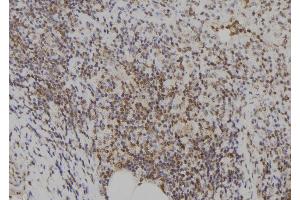 ABIN6273574 at 1/100 staining Human spleen tissue by IHC-P. (E2F7 Antikörper)