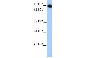 WB Suggested Anti-FOXO3 Antibody Titration:  0.