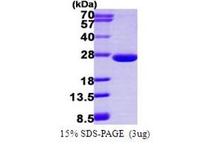 SDS-PAGE (SDS) image for ADP-Ribosylation Factor-Like 3 (ARL3) (AA 1-182) protein (His tag) (ABIN667566)